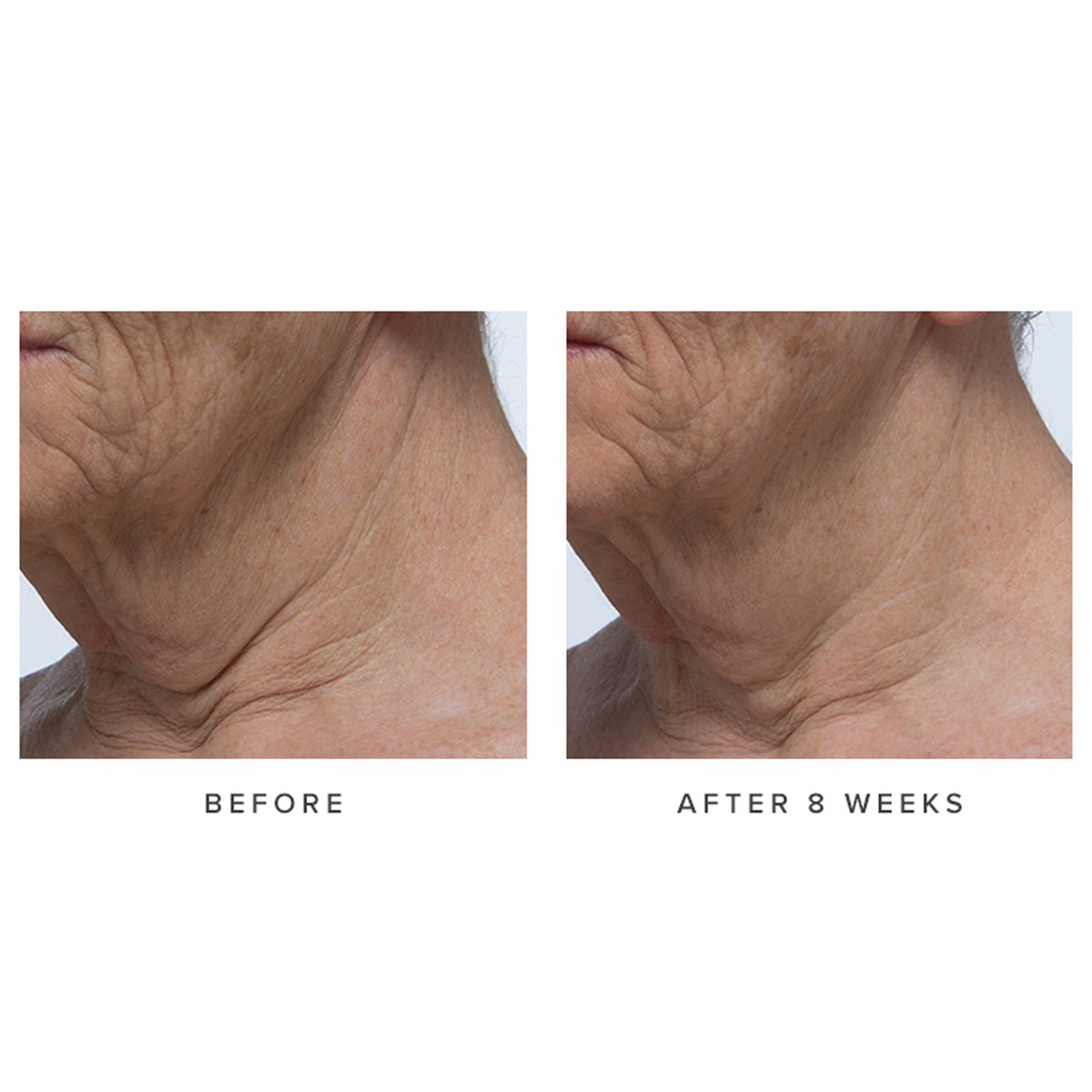 Tatcha Ageless Revitalizing Neck Cream - Image 4